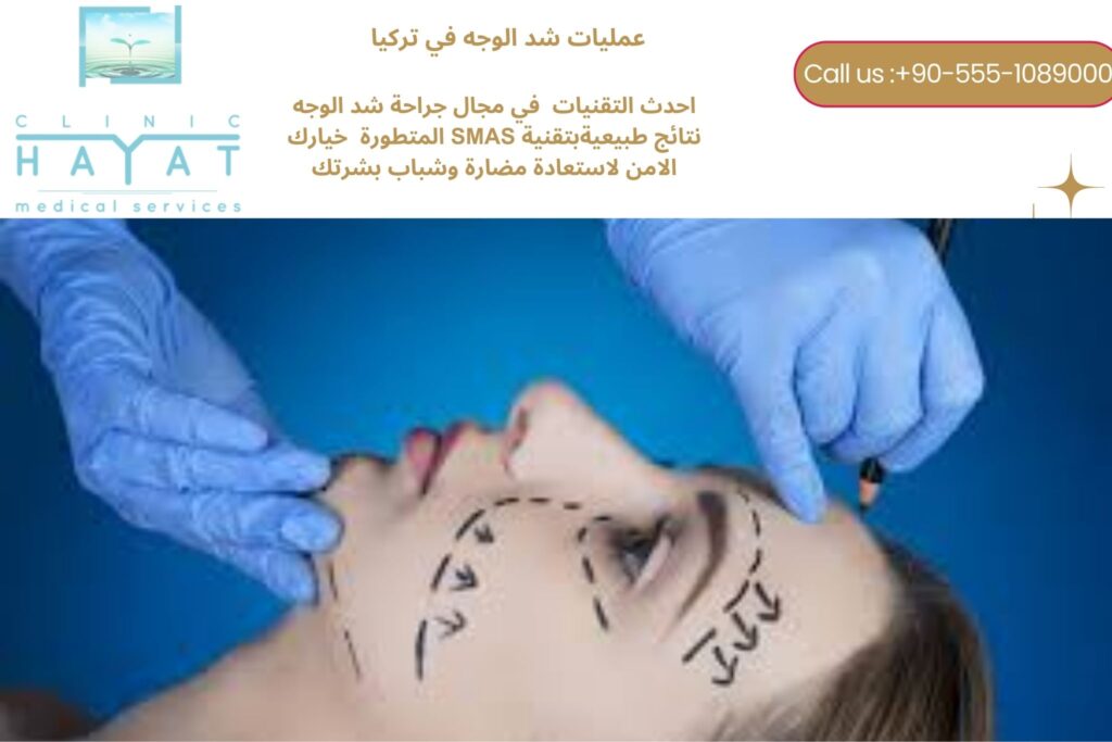 شد الوجه في تركيا 2026