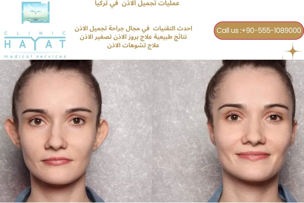 تجميل الأذن في تركيا 2026