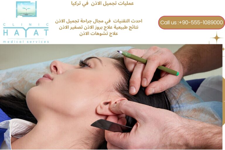 تجميل الأذن في تركيا 2026