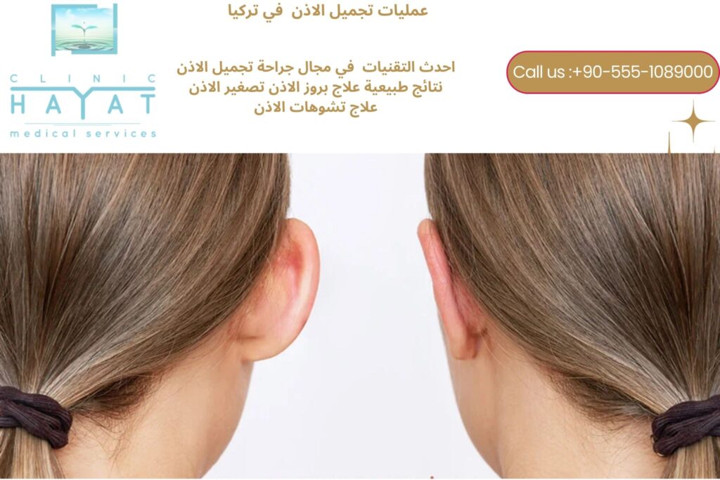 تجميل الأذن في تركيا