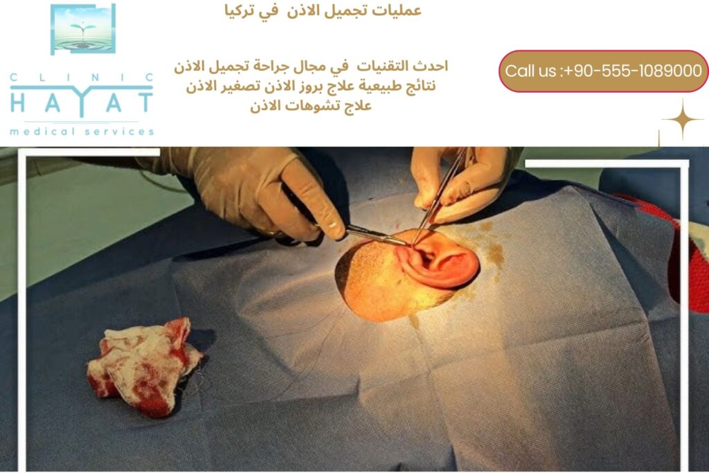 تجميل الأذن في تركيا 2026