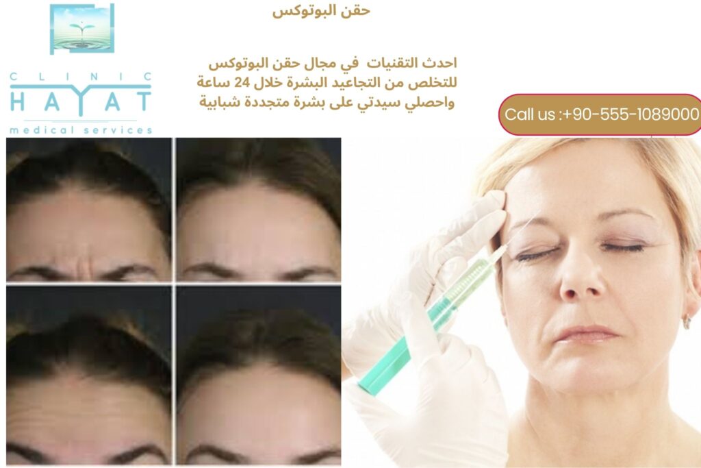 حقن البوتوكس في تركيا 2026