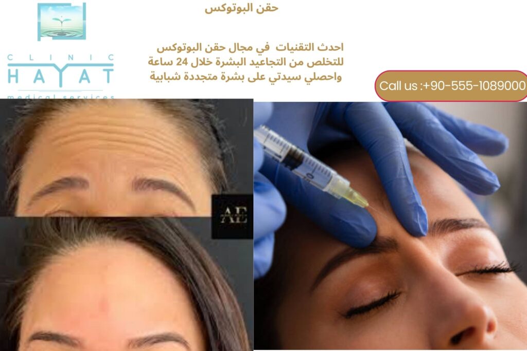 حقن ابر البوتوكس في تركيا