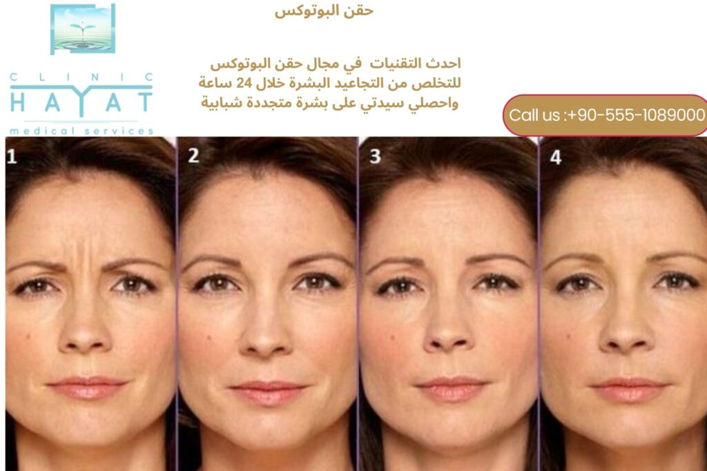 حقن البوتوكس في تركيا