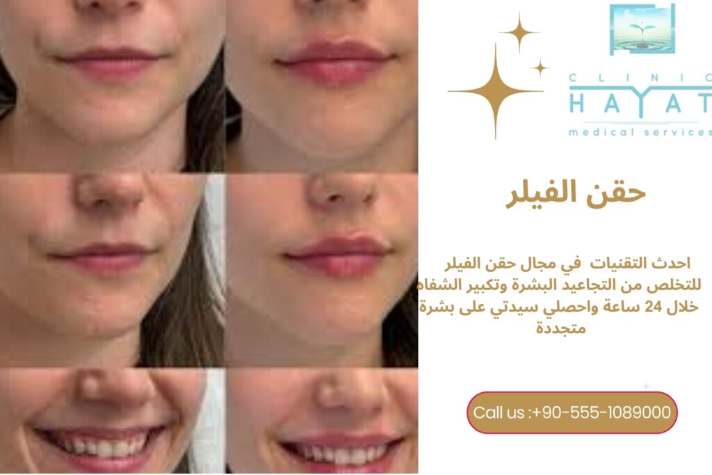 حقن الفيلر في تركيا 2026