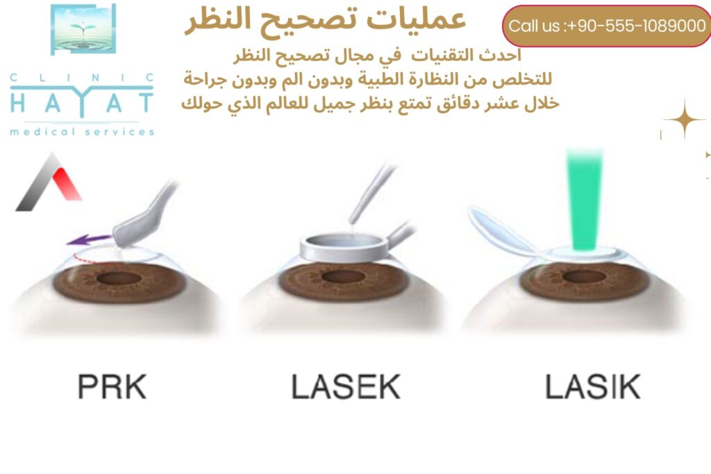 تصحيح النظر في تركيا 2026