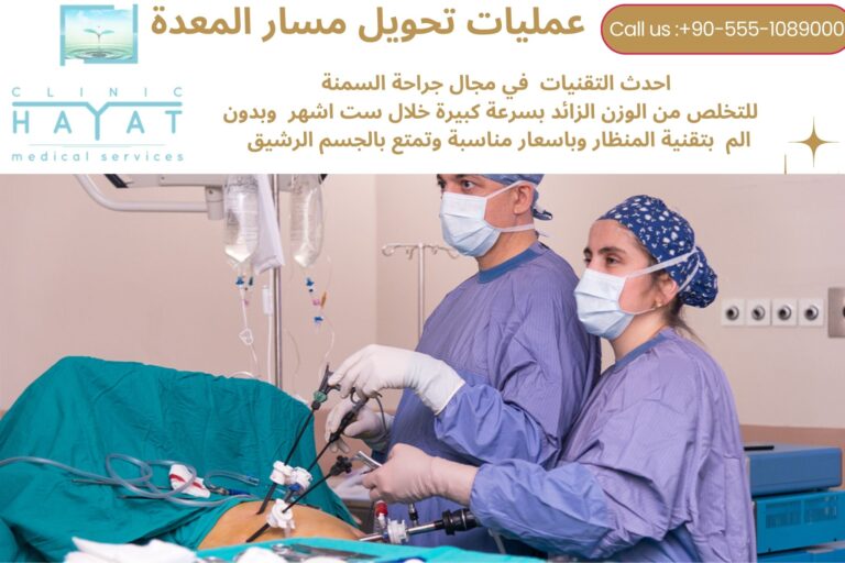 تحويل مسار المعدة في تركيا 2026