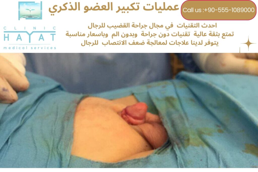 تكبير العضو الذكري في تركيا 2026