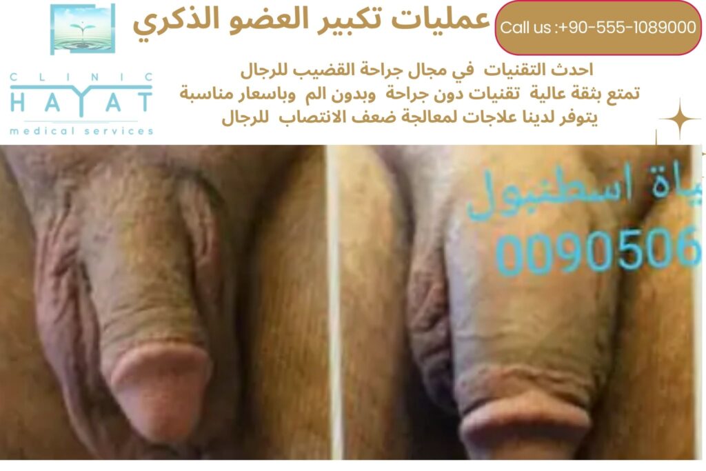 صور قبل وبعد تكبير القضيب في تركيا