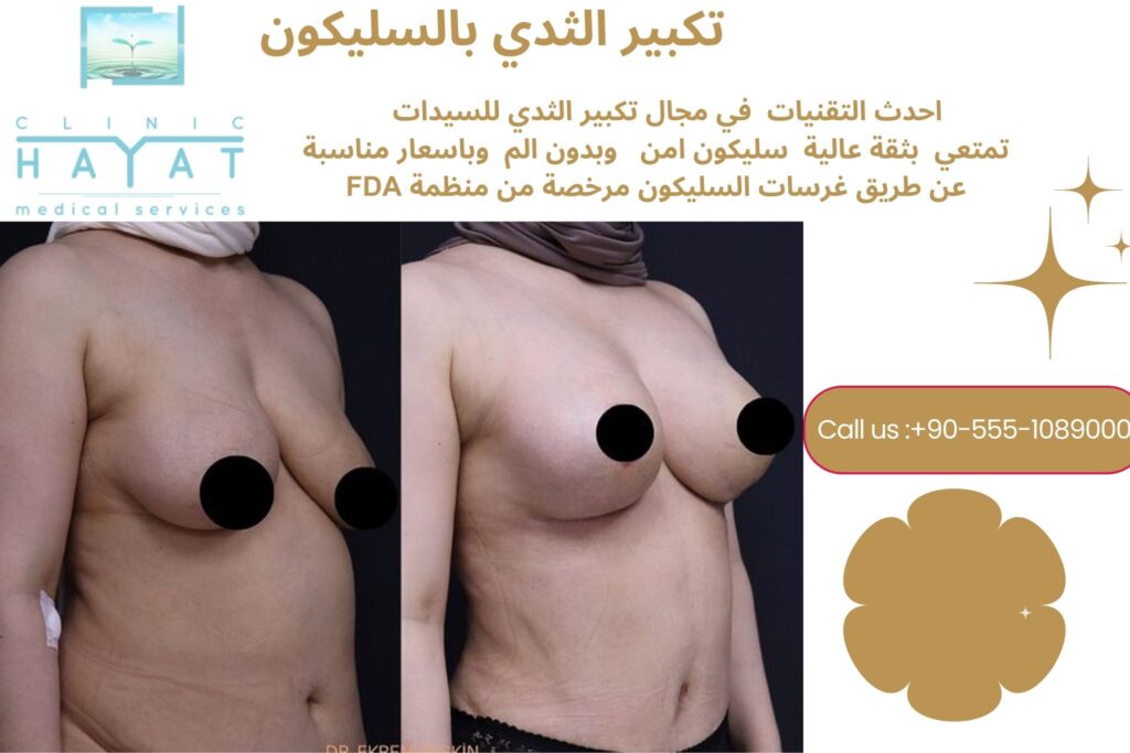 تكبير الثدي بالسليكون في تركيا