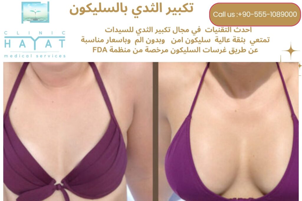 تكبير الثدي بالسليكون في تركيا