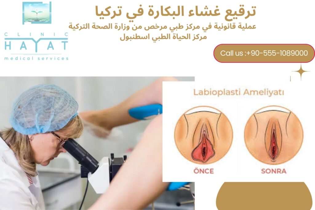 تكلفة وترقيع غشاء البكارة في تركيا 2026: كل ما تحتاج معرفته