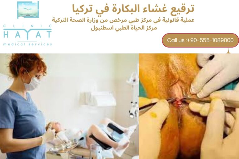 تكلفة وترقيع غشاء البكارة في تركيا 2026: كل ما تحتاج معرفته