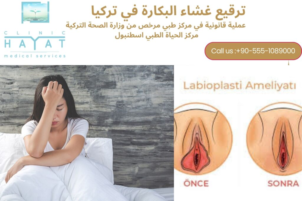 تكلفة وترقيع غشاء البكارة في تركيا 2026: كل ما تحتاج معرفته