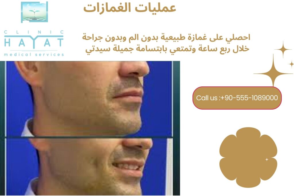 عملية الغمازات في تركيا 2026