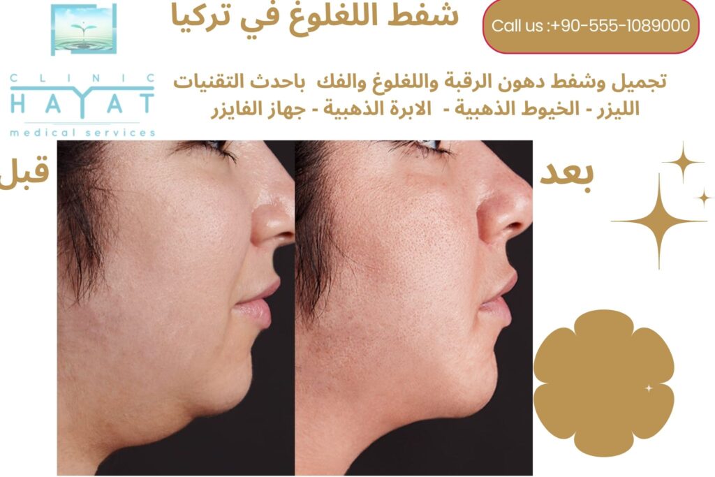 صور قبل وبعد شفط دهون اللغلوغ في اسطنبول