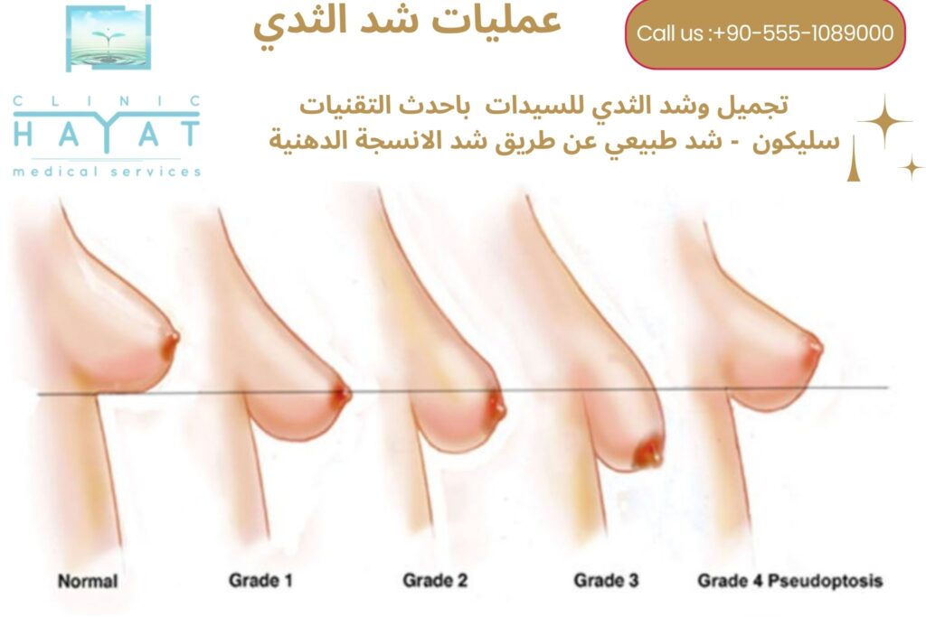 شد الثدي في تركيا 2026